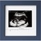 Baby Sonogram Picture Frame - Modern Ultrasound Frame For Mom To Be - Pregnancy Announcement Sonogram Photo Frames - Gender Reveal For Expecting Parents - First Time Dad Gifts (Midnight Blue)